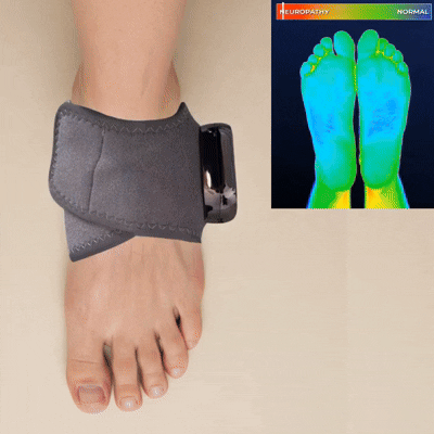 Relieve Burning Feet